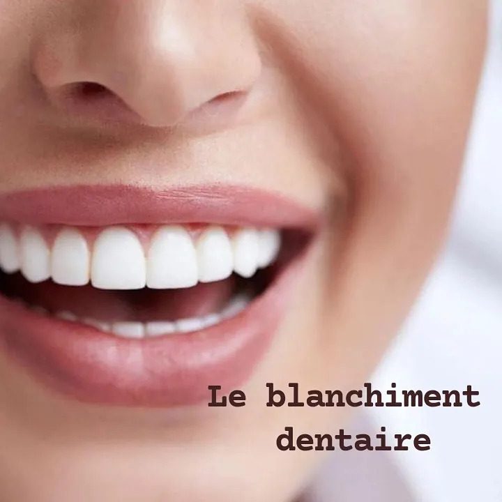 Blanchiment dentaire — cabinet Radiance