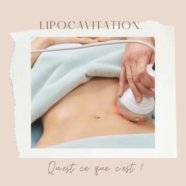 Lipocavitation — cabinet Radiance