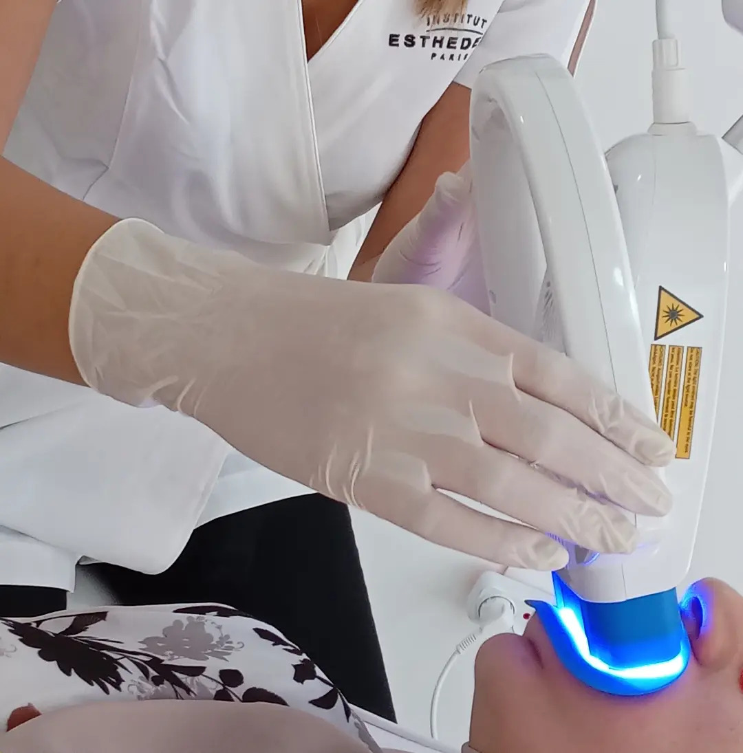 Épilation laser — cabinet Radiance